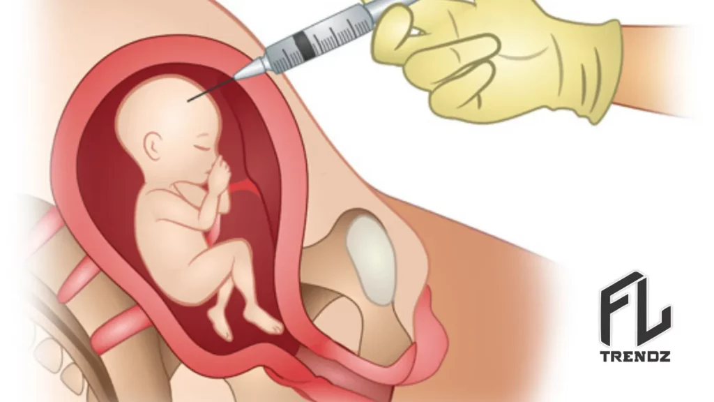 Surgical Abortion Procedure - FLTrendz 